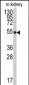 ALDH9A1 Antibody (N-term)